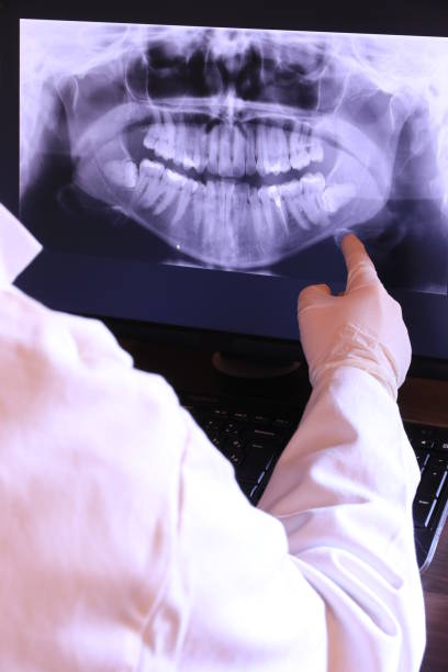 Best Broken or Chipped Tooth Repair in Brier, WA